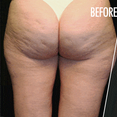 Бърз Резултат